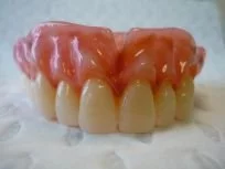 intermediate dentures